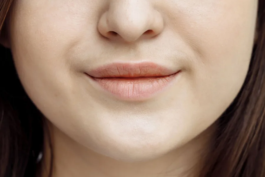 Pale, uneven lip tone before lip blush