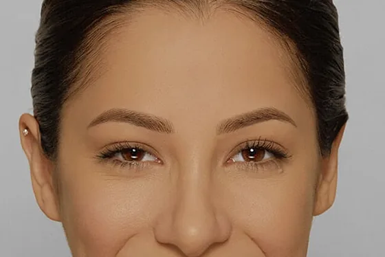 The same brow, fuller and defined, after treatment