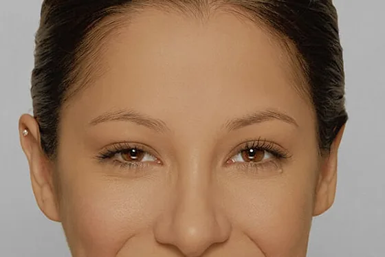 A natural brow before treatment
