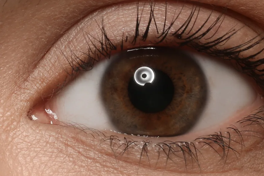 The same eye with a fuller, darker lash line after treatment