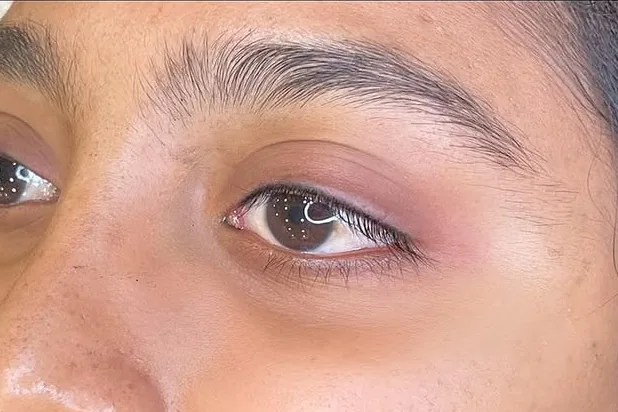 The same eye with a defined lash line after an eyeliner tattoo