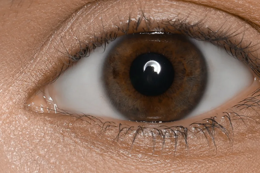 A natural lash line before treatment