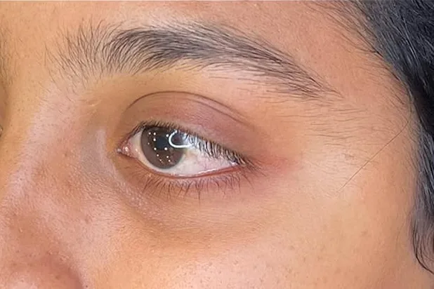 A bare lash line before an eyeliner tattoo