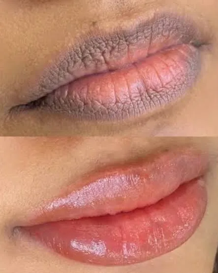 Lip blush result, healed